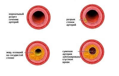 Алгоритм оформления нетрудоспособности