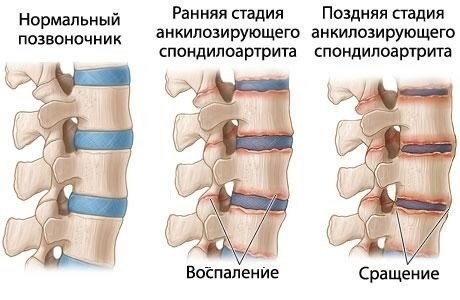 «Боль будет преследовать всю жизнь»